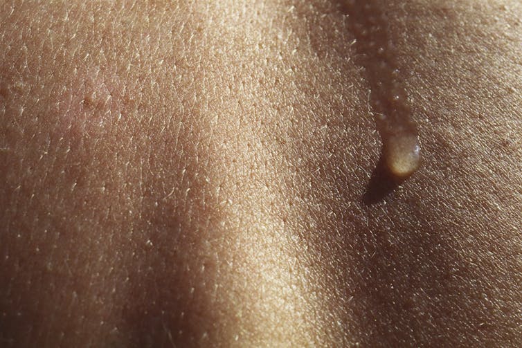 Close-up of skin, a water droplet sliding down